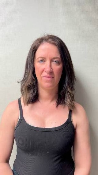 Rose chose to invest in herself with a breast augmentation, and she absolutely l